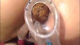 Girl Anal Speculum Shit, ScatKings.com Scat Porn 13 ScatKings.com Scat Porn
