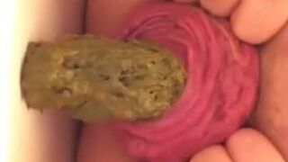 Prolapse Pro (Closeup), ScatKings.com Scat Porn 6 ScatKings.com Scat Porn